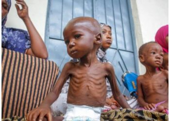 Nigerian Govt Confirms Widespread Malnutrition Among Children in Northeast and Northwest