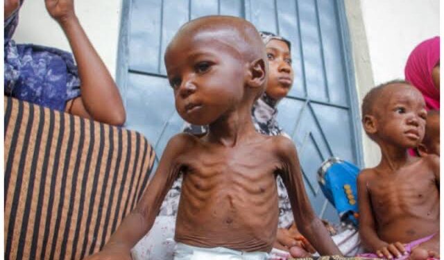 Nigerian Govt Confirms Widespread Malnutrition Among Children in Northeast and Northwest