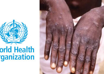Monkeypox: WHO Announces Global Strategy to Control Spread