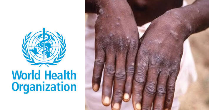 Monkeypox: WHO Announces Global Strategy to Control Spread