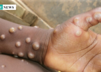 Cross River State Mobilize 200 Volunteers to Combat Mpox Outbreak