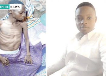 OAU Graduate Loses Battle to Renal Cancer Despite N9.4m Treatment